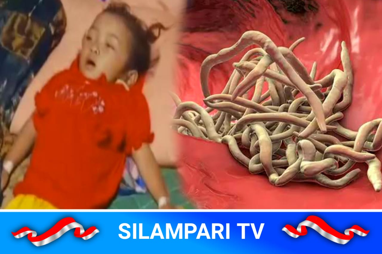 Kisah Tragis Raya, Balita Jawa Barat yang Meninggal Akibat Cacingan Parah.