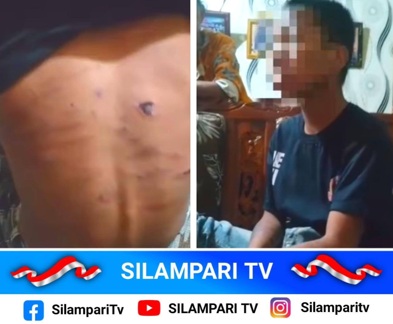Diduga Jadi Korban Penganiayaan, Remaja Binaan IPWL Lubuklinggau Mengalami Trauma