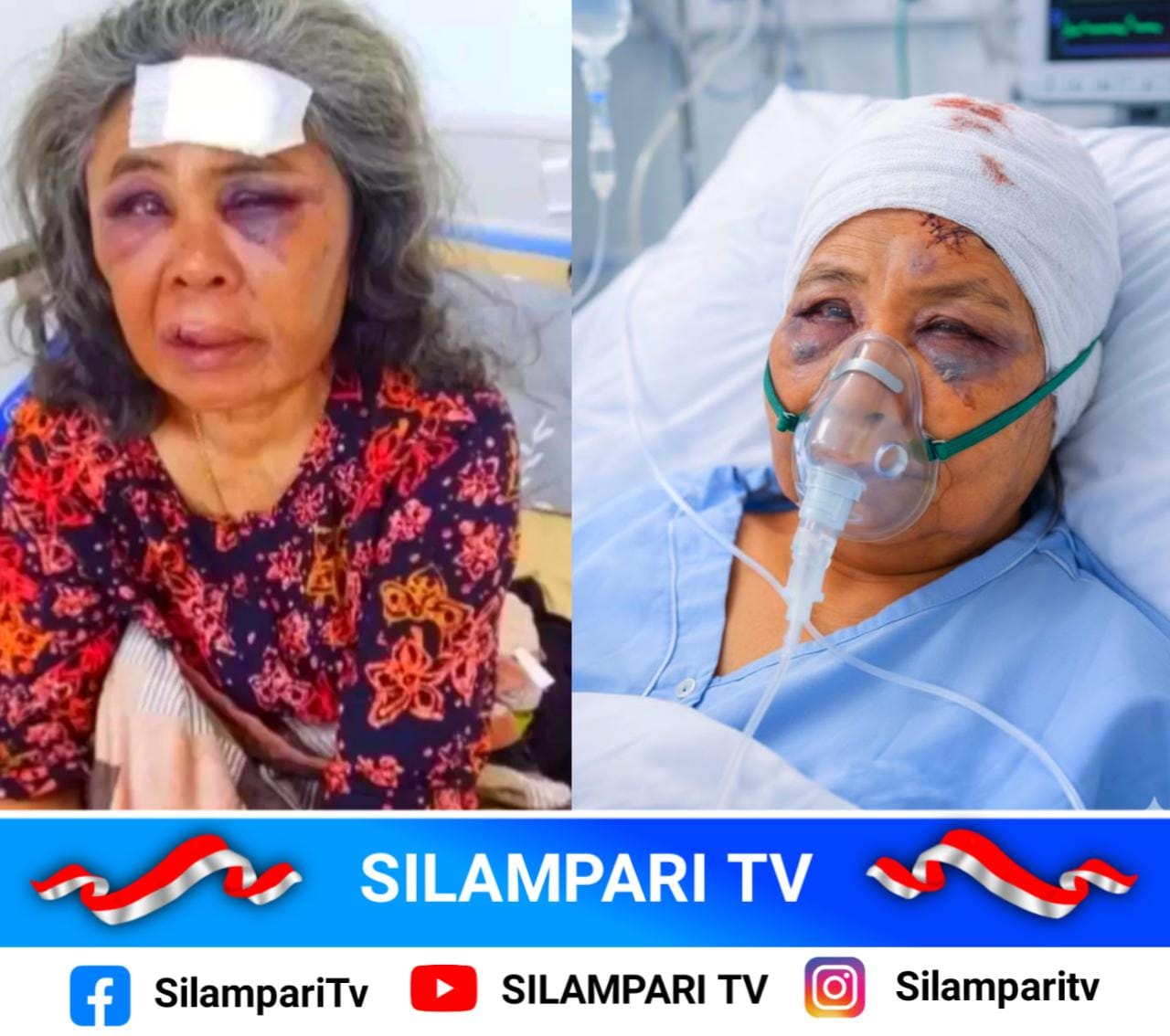 Nenek Saudah Jadi Korban Kekerasan Usai Menentang Tambang Emas Ilegal di Pasaman