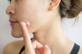 Tretinoin: Manfaat, Efek Samping, dan Bedanya dengan Retinol