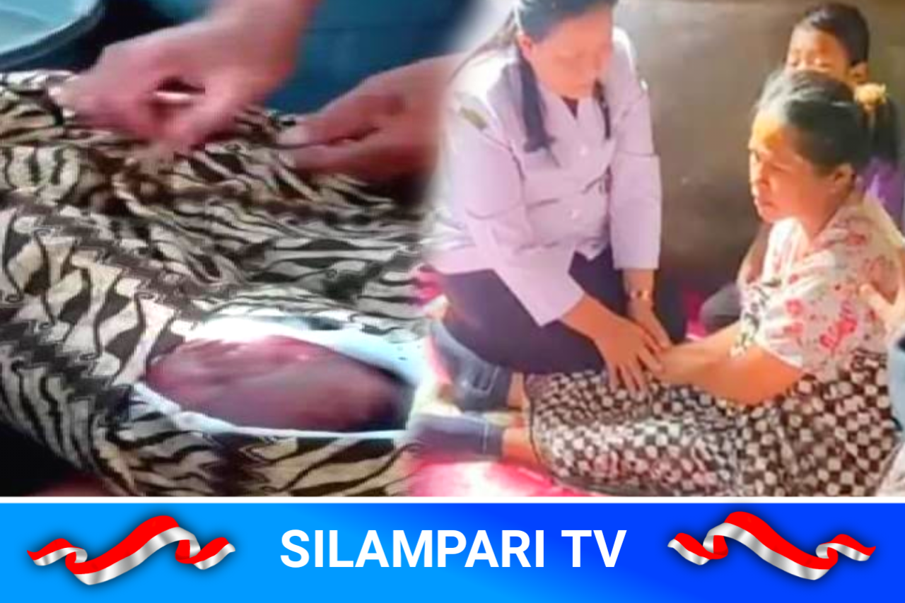 Kepala Bayi Putus Saat Persalinan di Puskesmas, Dinkes Tapteng: SOP Sudah Dijalankan