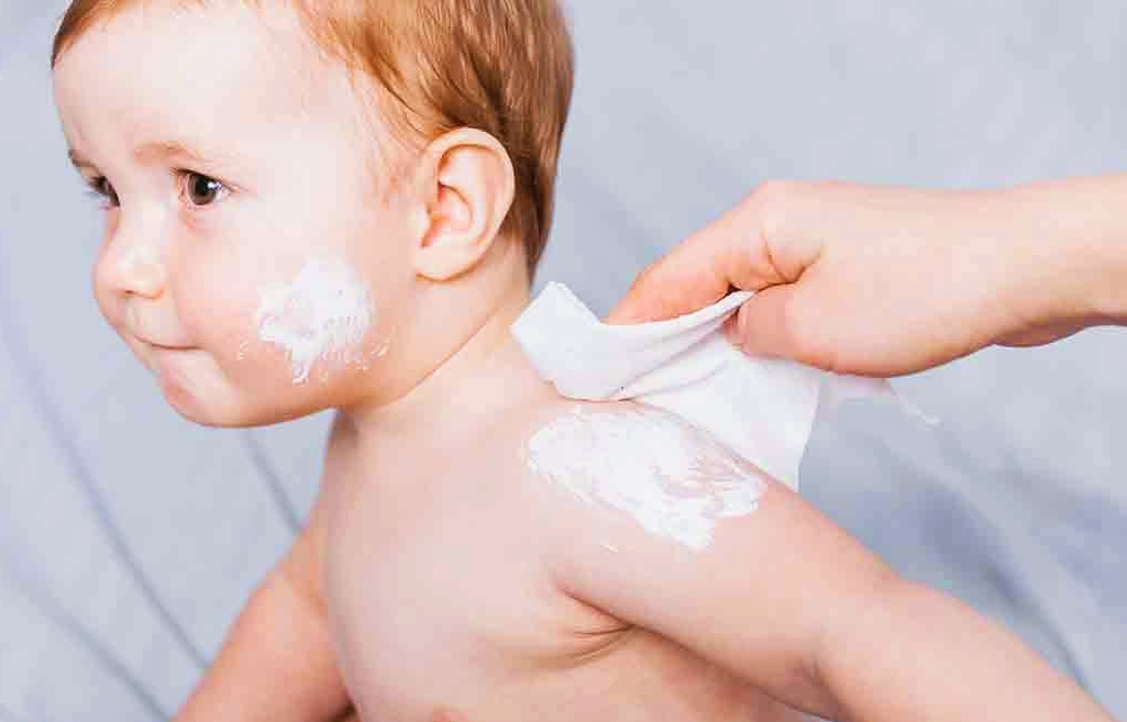 7 Tips Mengatasi Biang Keringat pada Bayi Secara Alami agar Kulit Tetap Sehat dan Lembut