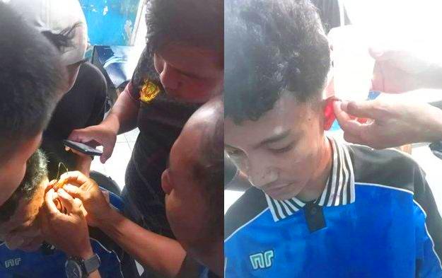 Pemuda di Lubuklinggau Datangi Damkar untuk Lepaskan Mata Kail di Telinga: Petugas Sarankan ke Faskes
