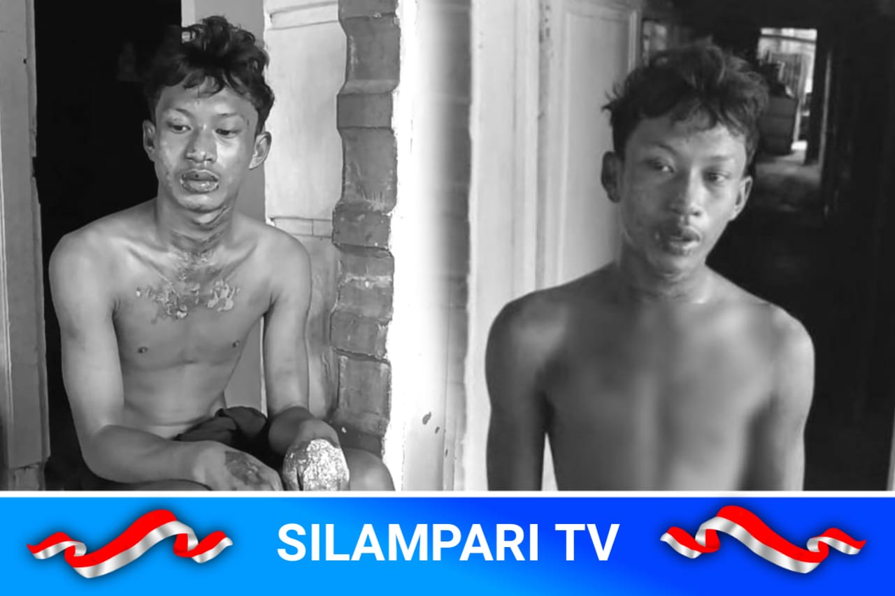 Pemuda Dibakar Hidup-Hidup Usai Kepergok Curi Ubi di Deli Serdang, Pelaku Diduga ASN dan Oknum Brimob.