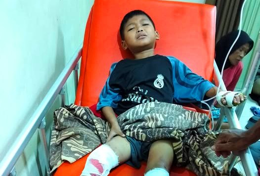 Kisah Pilu Haris, Bocah 6 Tahun Korban Tabrak Lari di Lubuklinggau: Kaki Kiri Harus Dioperasi