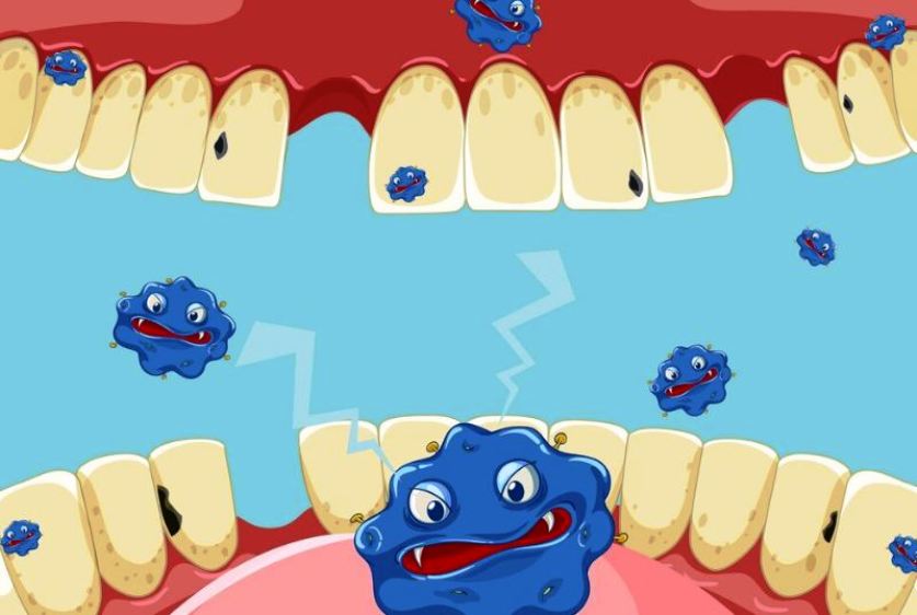 Tanpa Keluarkan Biaya Mahal, Ini Dia 7 Bahan Alami untuk Hilangkan Karang Gigi