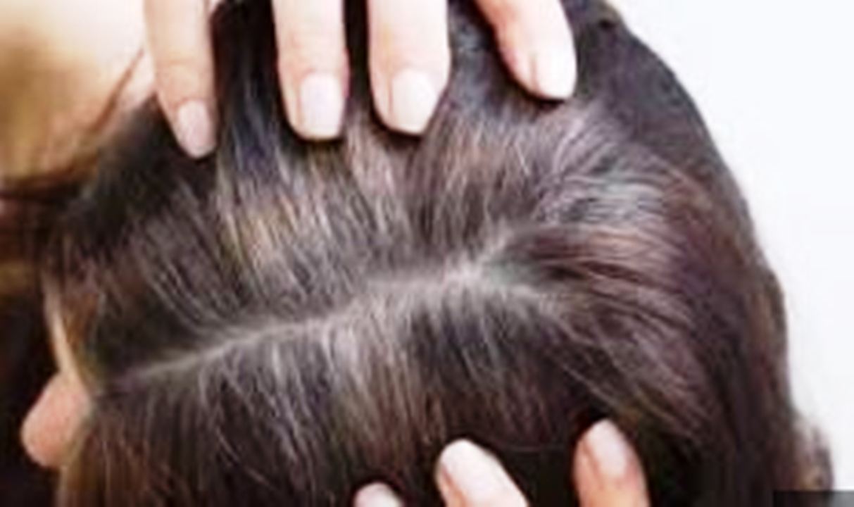 Tips Atasi Rambut Uban Agar Jadi Hitam Kembali