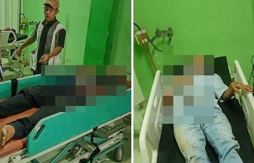 Jalan Rusak di Lubuklinggau Telan Korban: Dua Pemotor Terperosok ke Lubang, Satu Dilarikan ke Rumah Sakit