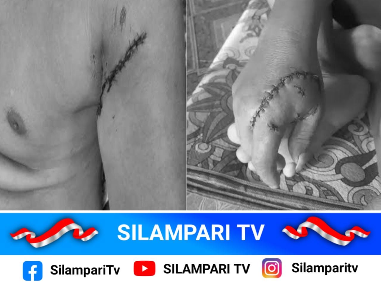 Heboh! Beruang Liar Serang Dua Petani di Rawas Ulu Muratara, Polisi dan BKSDA Turun Tangan