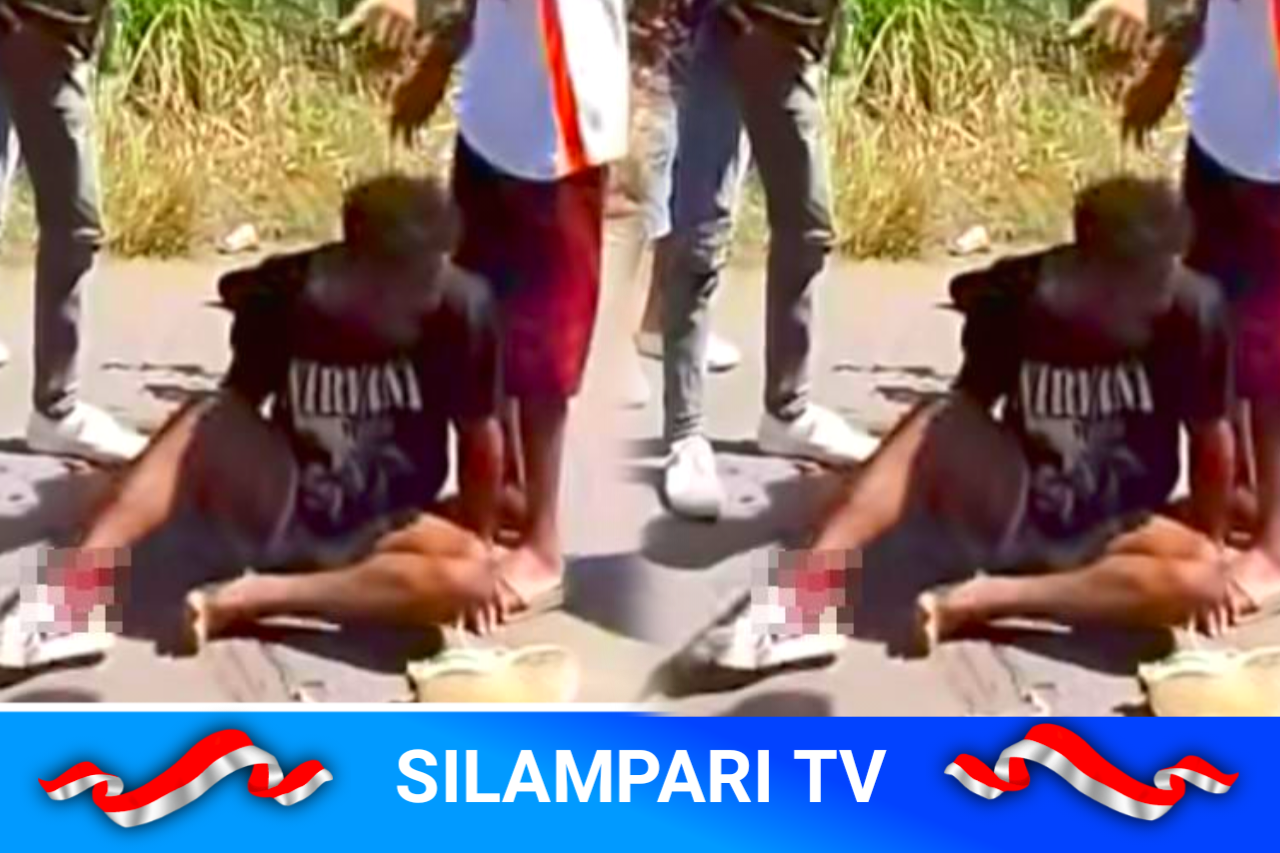 Kecelakaan di Tikungan Musi Rawas, Pemotor Terluka Parah Usai Hantam Truk.