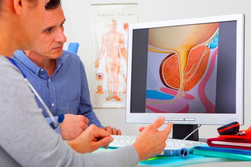 Kanker Prostat Mengintai Pria Dewasa, Ini Ciri-ciri Awalnya!