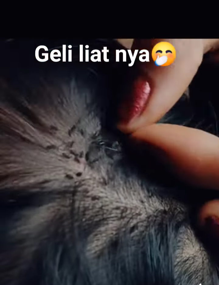 Bikin Geli, Namun Konten Mencari Kutu Lagi Viral Saat Ini, Bisa Hasilkan Puluhan Dollar, Inilah Tanda Ada Kutu