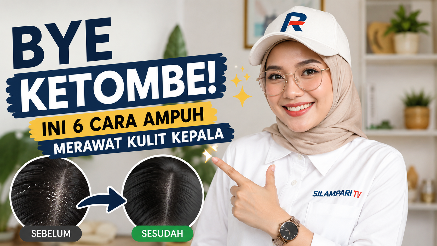 Bye Ketombe! Ini 6 Cara Ampuh Merawat Kulit Kepala