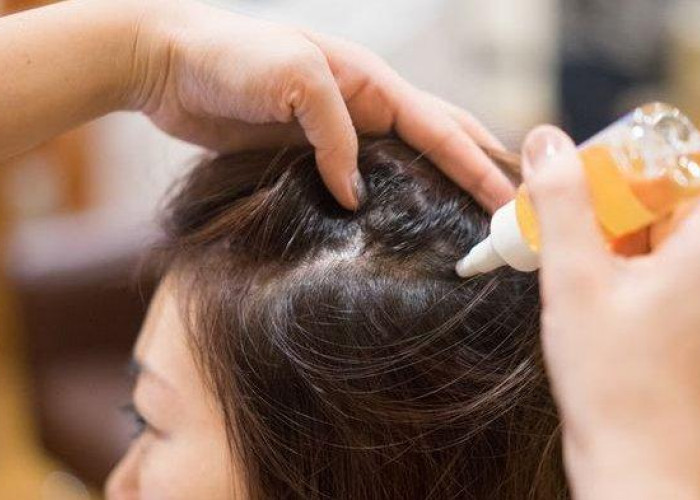 3 Pilihan Serum Penumbuh Rambut, Melebatkan Rambut dengan Efektif!