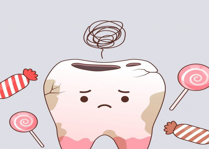 Mengapa Gigi Berlubang? Penyebab dan Faktor Risiko yang Harus Diketahui