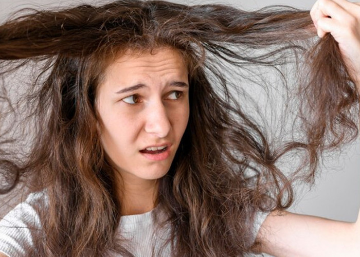 7 Penyebab Umum Rambut Kering yang Perlu Anda Ketahui