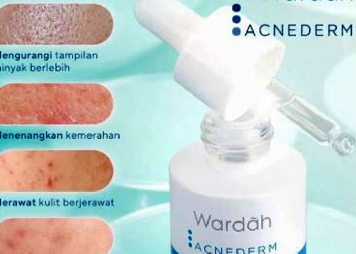 5 Serum Wardah yang Bisa Atasi Flek Hitam dan Kulit Wajah Kusam