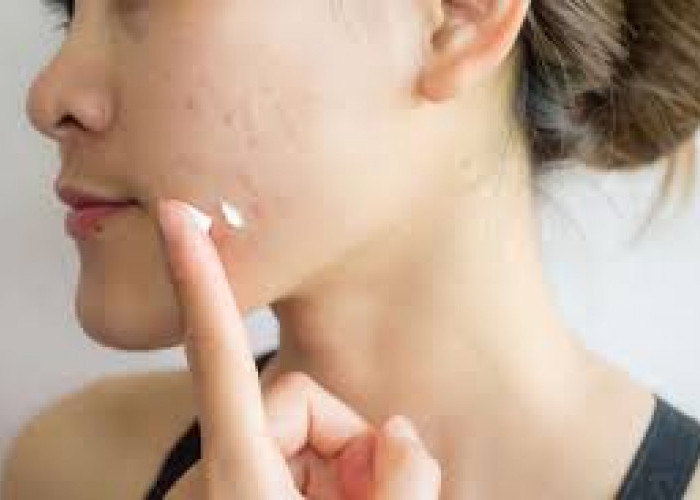 Tretinoin: Manfaat, Efek Samping, dan Bedanya dengan Retinol