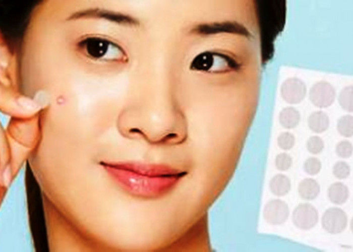 Menutup Jerawat dengan Acne Patch: Apakah Cepat Kempes? Ini Menurut Ahli Kesehatan Kulit