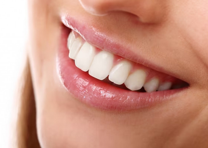7 Cara Menjaga Kesehatan Gigi untuk Senyuman Berseri