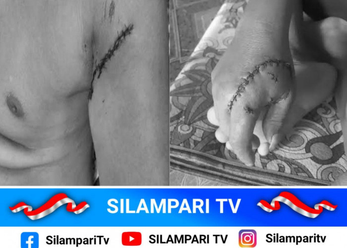 Heboh! Beruang Liar Serang Dua Petani di Rawas Ulu Muratara, Polisi dan BKSDA Turun Tangan