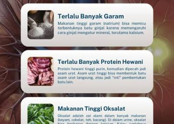 Jangan Cuma Kurang Minum! Pola Makan Ternyata Jadi Pemicu Utama Batu Ginjal, Ini Makanan yang Perlu Dibatasi