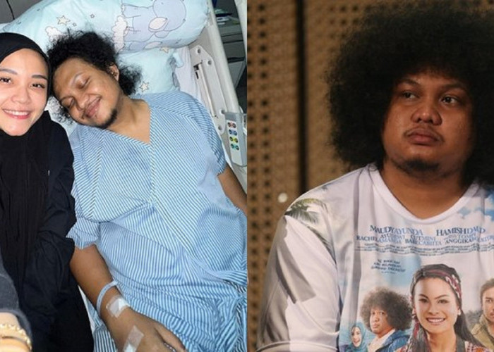 Babe Cabita Meninggal Jelang Lebaran, Ini Penjelsan Ahli dari UI Penyakit Autoimun