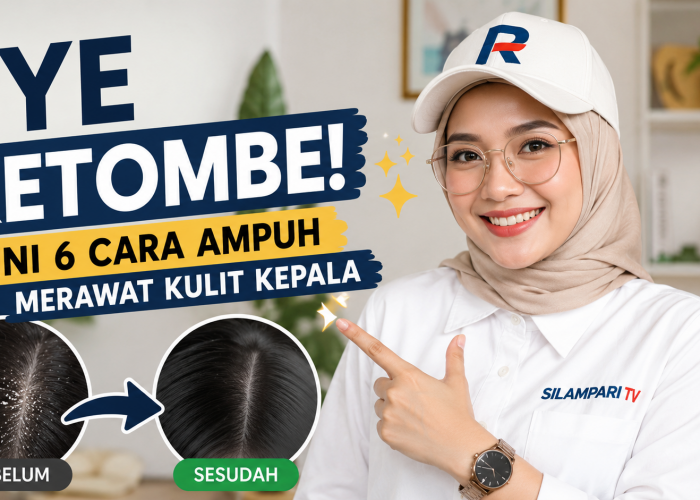 Bye Ketombe! Ini 6 Cara Ampuh Merawat Kulit Kepala