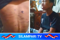 Diduga Jadi Korban Penganiayaan, Remaja Binaan IPWL Lubuklinggau Mengalami Trauma