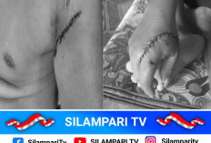 Heboh! Beruang Liar Serang Dua Petani di Rawas Ulu Muratara, Polisi dan BKSDA Turun Tangan