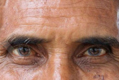 Waspada Katarak pada Lansia: Kenali Penyebab dan Cara Mencegahnya Sejak Dini