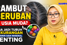 Rambut Beruban di Usia Muda? Bisa Jadi Tubuh Kekurangan Vitamin dan Mineral Penting
